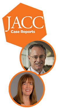 JACC: Case Reports